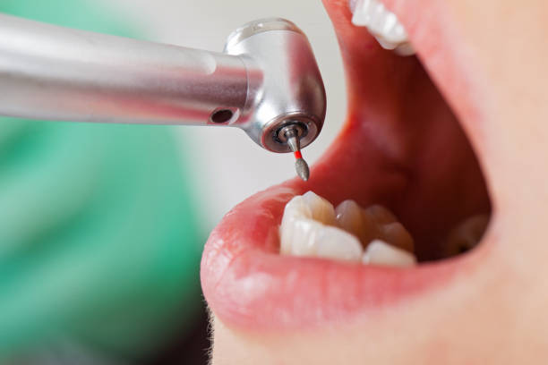 Best Pediatric Emergency Dentist in Atascocita, TX